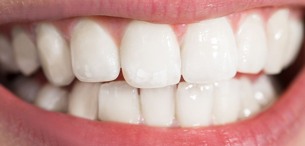 ✨ New Year. New Smile. January Whitening Special Offer! ✨