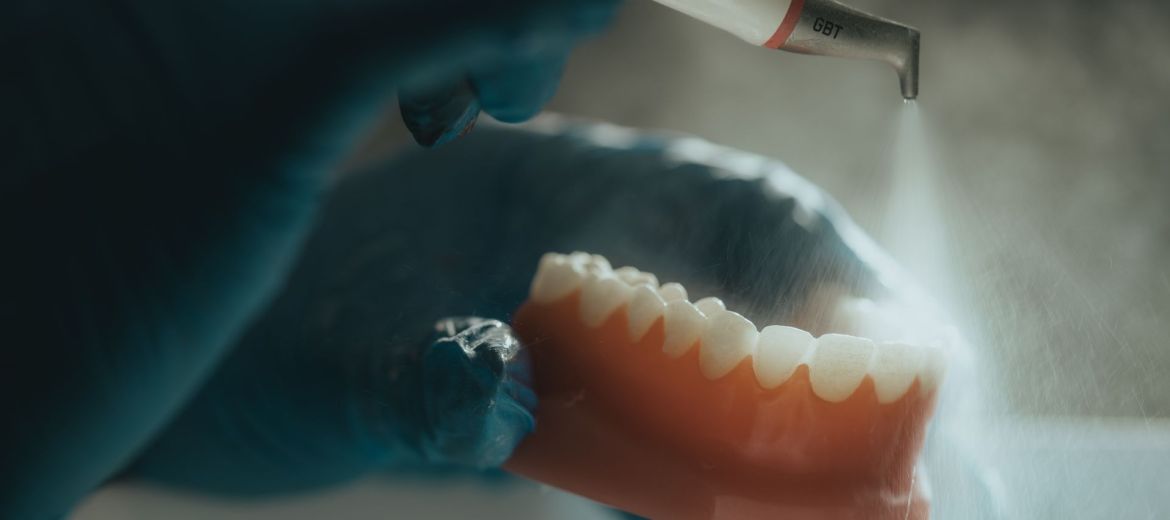 EMS Airflow® Guided Biofilm Therapy (GBT) in Manchester & Prestwich
