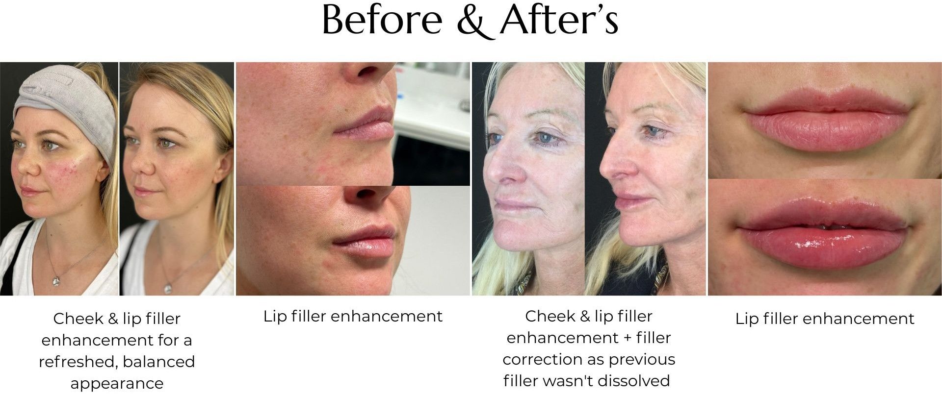 before and after