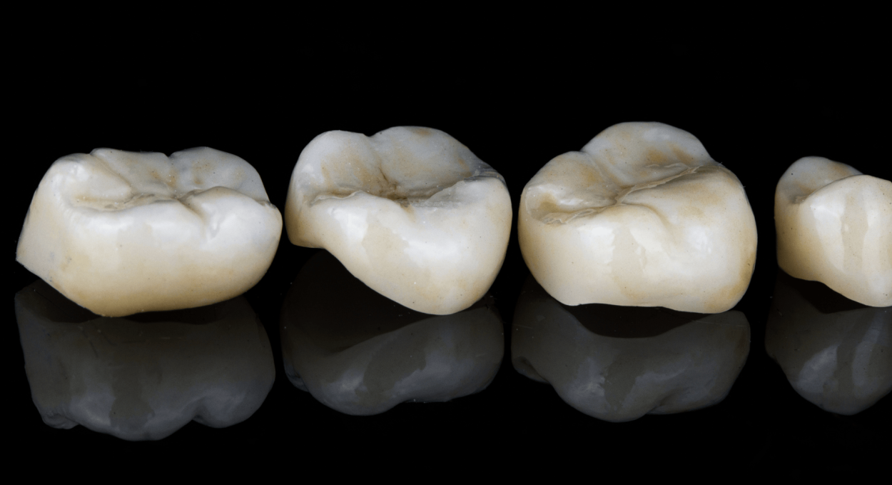 Dental crown at Oakley